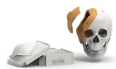 TEMPLATE PARA CRANIOPLASTIA PROTOTIPAGEM